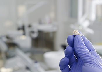 Dentist hand in blue protective glove holding a tooth