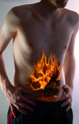 Irritable Bowel Syndrome  