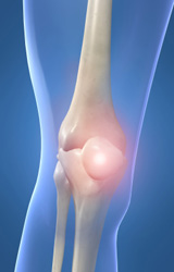 Knee Pain 